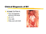 Clinical Diagnosis