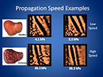 Propagation Speed